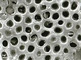 5 - Cellule epitalliche in visione superficiale
